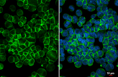 Anti-PLVAP antibody [HL5858] used in Immunocytochemistry/ Immunofluorescence (ICC/IF). GTX647176